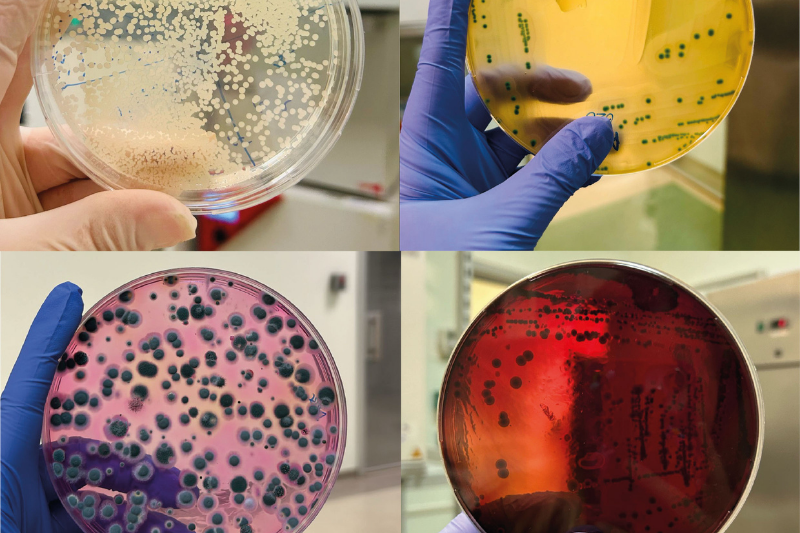 Küf Maya ve Listeria'ya Karşı Mikrobiyolojik Testler